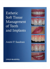 Esthetic Soft Tissue Management Of Teeth And Implants Hardcover