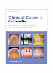 Clinical Cases In Prosthodontics Paperback