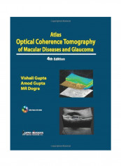 Atlas Optical Coherence Tomography Of Macular Diseases And Glaucoma Paperback 4