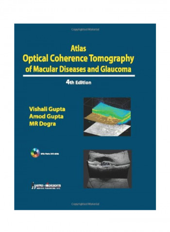 Atlas Optical Coherence Tomography Of Macular Diseases And Glaucoma Paperback 4