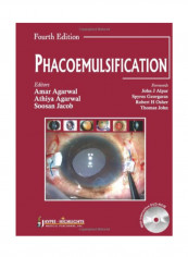 Phacoemulsification Paperback 4