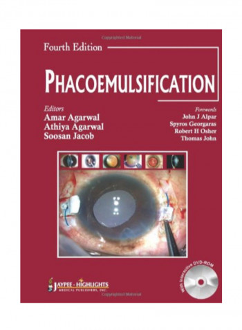 Phacoemulsification Paperback 4
