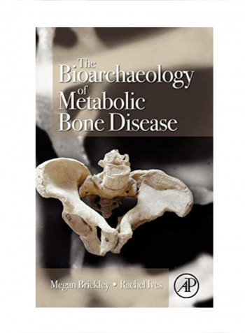 The Bioarchaeology Of Metabolic Bone Disease Hardcover 1