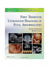 First Trimester Ultrasound Diagnosis Of Fetal Abnormalities Hardcover
