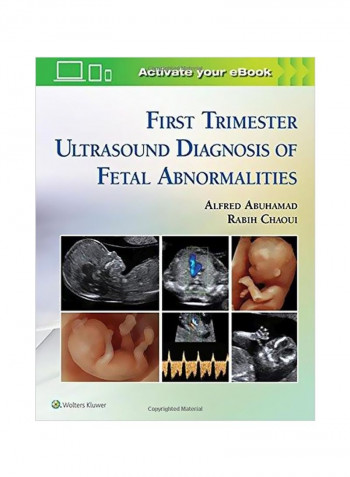First Trimester Ultrasound Diagnosis Of Fetal Abnormalities Hardcover