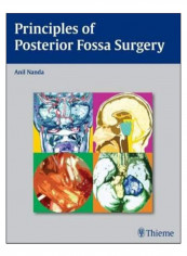 Principles Of Posterior Fossa Surgery Hardcover 1st edition
