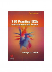 150 Practice Ecgs: Interpretation And Review Paperback