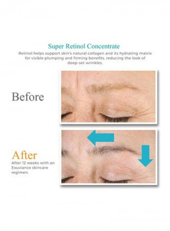 Super Retinol Concentrate Eye Cream 1ounce