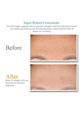 Super Retinol Concentrate 1ounce