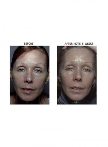 Anti Wrinkle Face Serum 1ounce