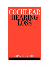 Cochlear Hearing Loss Paperback
