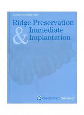 Ridge Preservation And Immediate Implantation Hardcover reviews Ridge Preservation And Immediate Implantation Hardcover
