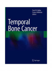 Temporal Bone Cancer Hardcover