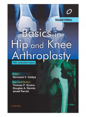 Basics In Hip And Knee Arthroplasty Hardcover 2nd Edition