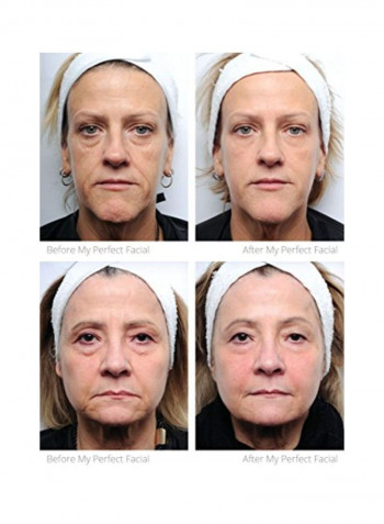 Facial Contouring Treatment Kit