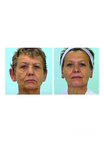 Facial Contouring Treatment Kit
