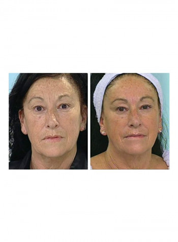 Facial Contouring Treatment Kit