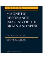 Mri Of The Brain And Spine Audiobook English by Scoot W. Atlas