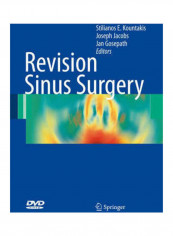 Revision Sinus Surgery Paperback English by Stilianos E. Kountakis