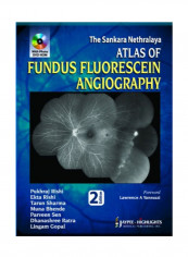 Atlas Of Fundus Fluorescein Angiography Paperback 2