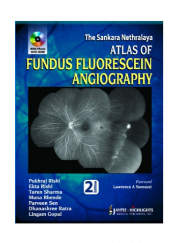Atlas Of Fundus Fluorescein Angiography Paperback 2