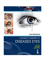 Cataract Surgery In Diseased Eyes Hardcover 1