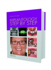 Implantology Step By Step Hardcover English by Christoph T. Sliwowski