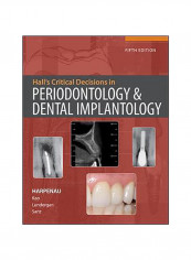 Hall'S Critical Decisions In Periodontology Hardcover reviews Hall'S Critical Decisions In Periodontology Hardcover
