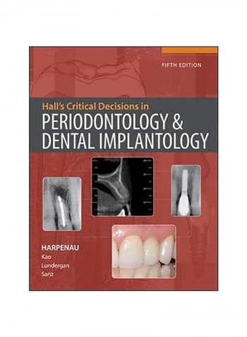 Hall'S Critical Decisions In Periodontology Hardcover