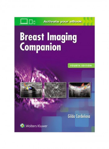 Breast Imaging Companion Paperback