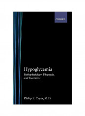 Hypoglycemia: Pathophysiology, Diagnosis, And Treatment Hardcover