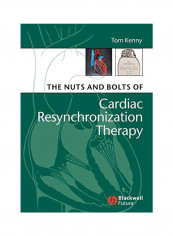 The Nuts And Bolts Of Cardiac Resynchronization Therapy Paperback