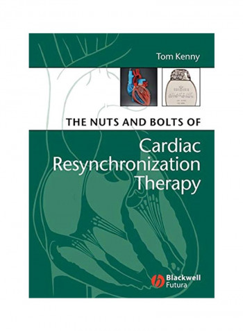 The Nuts And Bolts Of Cardiac Resynchronization Therapy Paperback