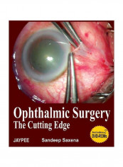 Ophthalmic Surgerythe Cutting Edge Audio Book reviews Ophthalmic Surgerythe Cutting Edge Audio Book