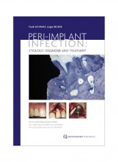 Peri-Implant Infection: Etiology, Diagnosis And Treatment Paperback