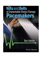The Nuts And Bolts Of Implantable Device Therapy: Pacemakers Paperback