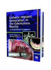 Esthetic Implant Restoration in the Edentulous Maxilla: A Simplified Protocol Hardcover English by Karim Dada