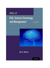 Atlas Of Eeg, Seizure Semiology, And Management Hardcover 2