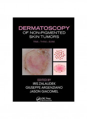 Dermatoscopy Of Non-Pigmented Skin Tumors Hardcover