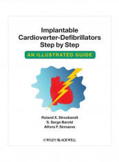 Implantable Cardioverter: Defibrillators Step By Step An Illustrated Guide Paperback