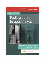 Workbook For Radiographic Image Analysis Paperback