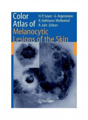 Color Atlas Of Melanocytic Lesions Of The Skin Hardcover English by H. Peter Soyer
