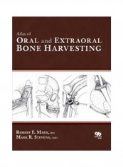 Atlas Of Oral And Extraoral Bone Harvesting Hardcover