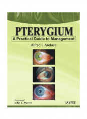 Pterygium - A Practical Guide To Management Paperback 1