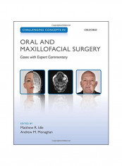 Challenging Concepts In Oral And Maxillofacial Surgery Paperback