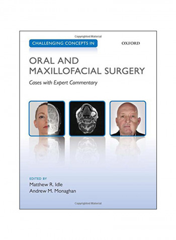 Challenging Concepts In Oral And Maxillofacial Surgery Paperback