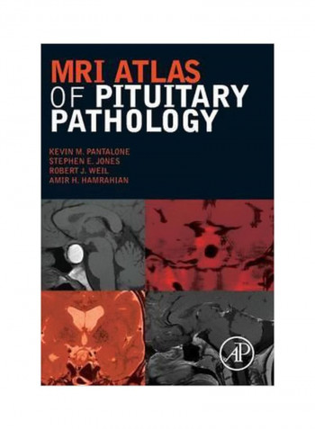 MRI Atlas Of Pituitary Pathology Hardcover