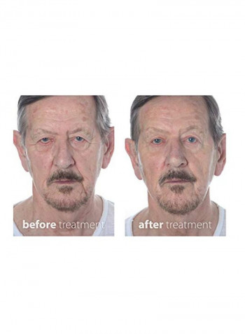 5 Anti-Ageing Treatment Kit