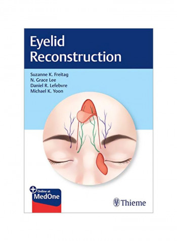 Eyelid Reconstruction Hardcover