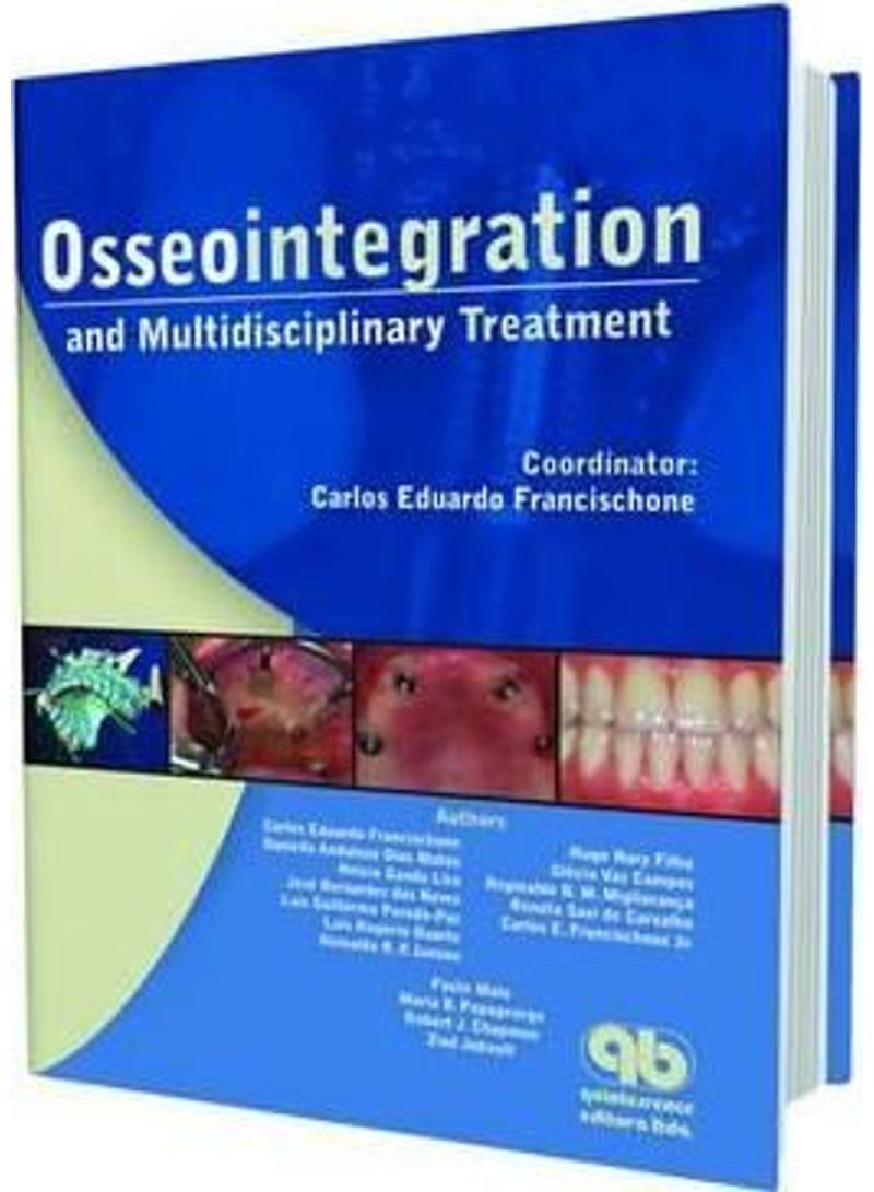 Osseointegration and Multidisciplinary Treatment Hardcover English by Carlos Francischone - 01032018